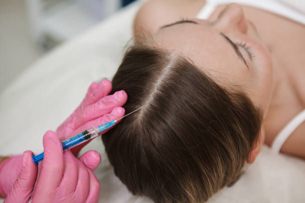 Can PRP Hair Treatment Improve Hair Thickness?