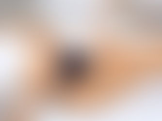 Does Laser Hair Removal work on dark skin tones?