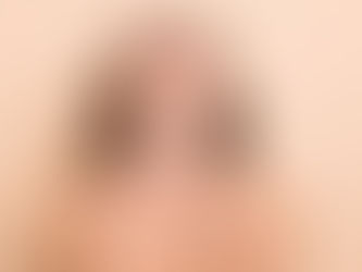 Is Neck Lift Surgery Right for Loose Neck Skin?