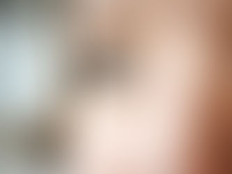 Can Eyelid Surgery Fix Droopy Eyelids Permanently?