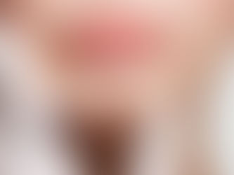 How long do Russian lip Fillers results last?