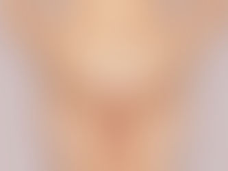 How Does Vaginoplasty Surgery Improve Comfort?