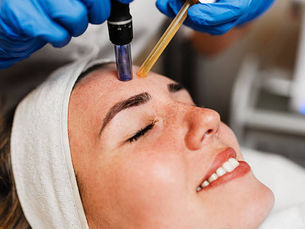 How Does Microneedling Improve Skin Texture?