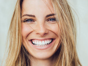 How Long Does Teeth Whitening  Results Last?