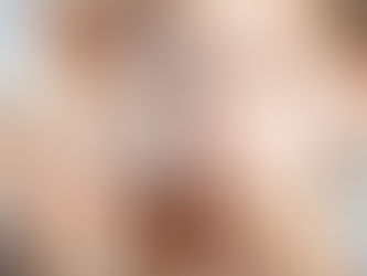 Can Chemical Peel Remove Acne Scars Quickly?