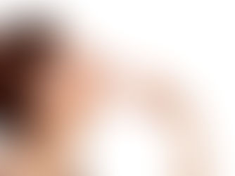 Does Botox for Nose Help Nasal Flare Issues?