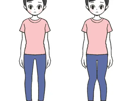 X脚O脚の女性