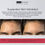 Thumbnail: Bottle Dermorepubliq 7% Glycolic Acid (AHA) Skin Renewing Toner 100 ml