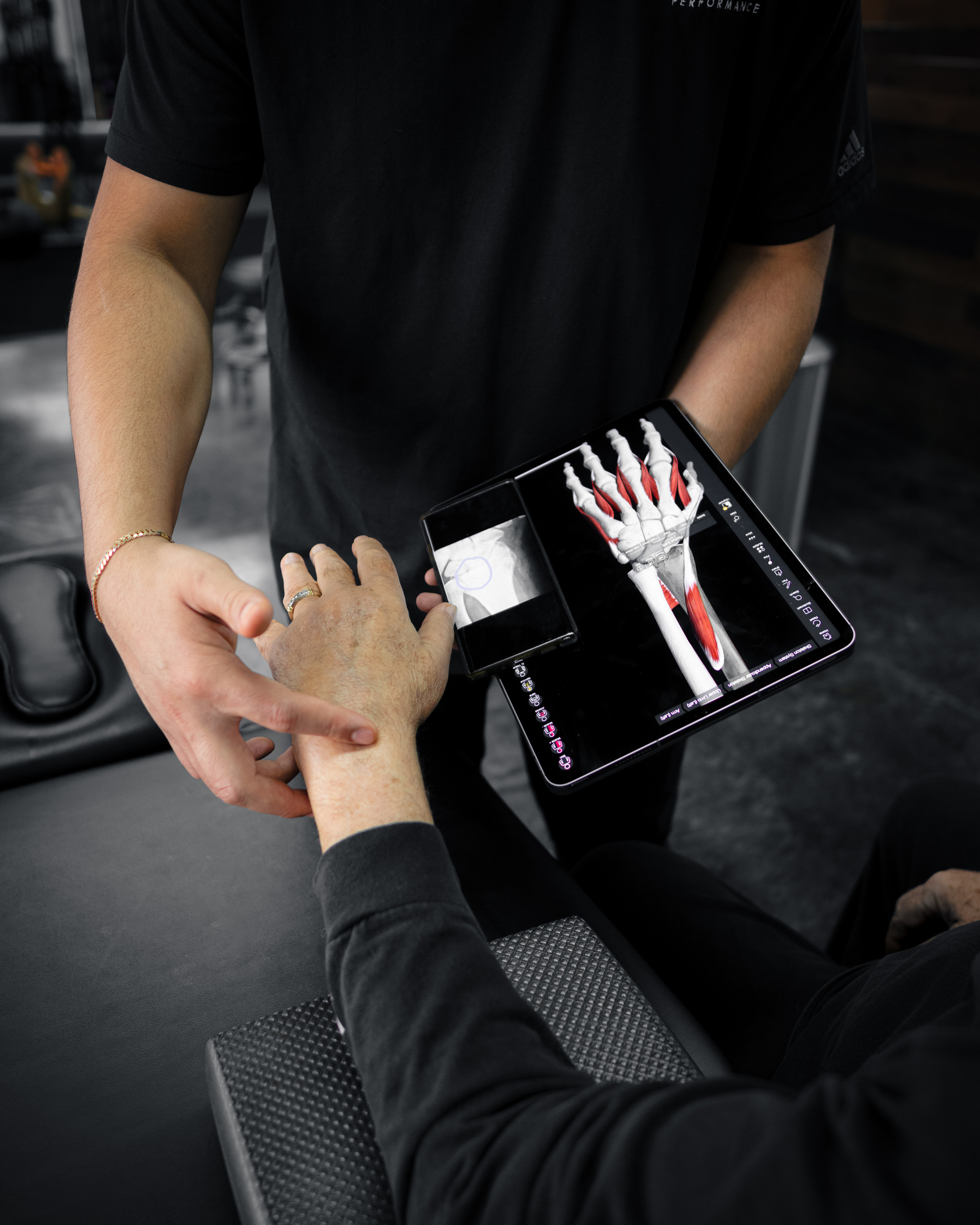 Moveo Performance Arm and Hand Rehabilitation | McAllen, TX | Moveo Performance