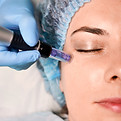 microneedling 1.jpg