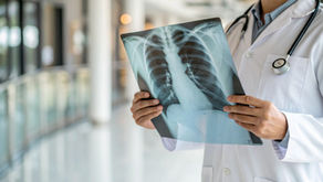 EPOC y cáncer de pulmón: amenazas para la salud pública