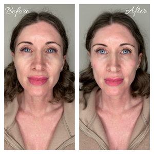 Facial Aesthetic Transformations
