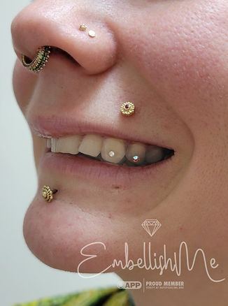 Rebekah tooth_wm.jpg