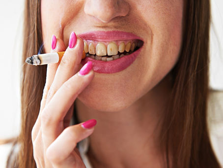 How Smoking Can Affect Your Teeth