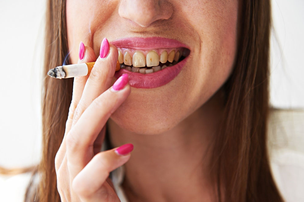 How Smoking Can Affect Your Teeth