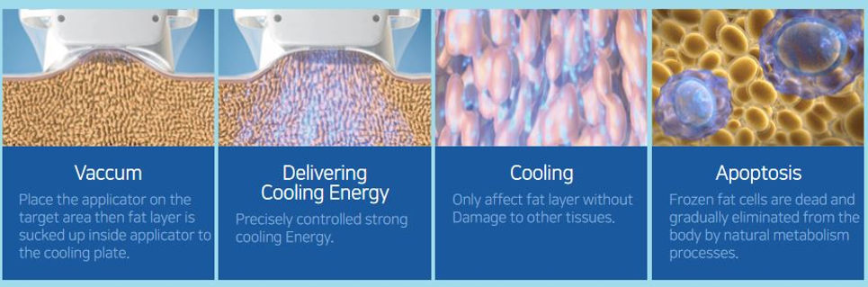 MediCel MiCool Process