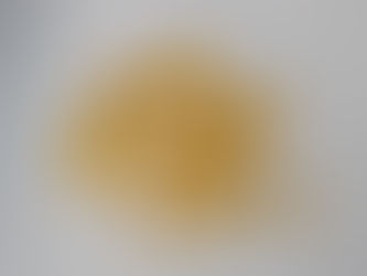 Vitamin D Deficiency: Causes, Symptoms & Simple Fixes