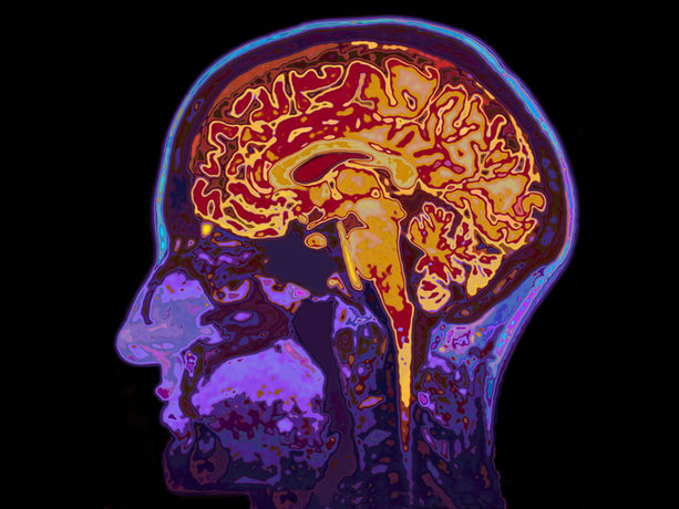 Déjà Vu: Why Your Brain Thinks the Present Is a Memory