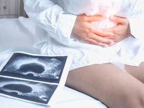 Understanding Ovarian Cysts: Causes, Symptoms, and Management