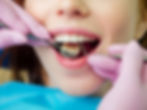 professional teeth check up