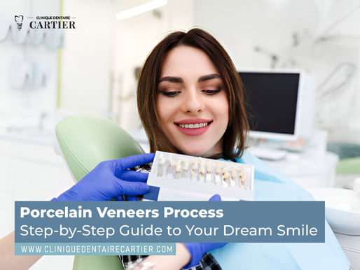 Porcelain Veneers Process: Step-by-Step Guide to Your Dream Smile