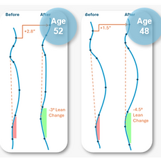 Image of before and afters