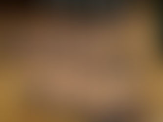 Unlocking the Power of Cupping Therapy: How Cupping Relieves Pain, Enhances Recovery, and Promotes Relaxation