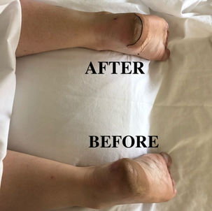 Ankle Supination