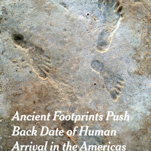 Modern shoes, modern gait, modern problems…