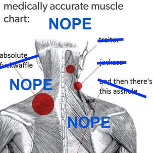 anatomical drawing with common pain areas marked with "absolute fuckwaffle," "traitor," "jackass," and "and then there's this asshole." All are crossed out and overwritten with "NOPE"