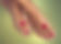 photo of feet with red stars on the tops of the foot between the bones of the big toe and second toe