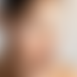 Mission: Moisturizer (Study 26-28)