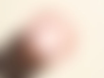 STUDY FULL: Moisturizer (Study 25-85)