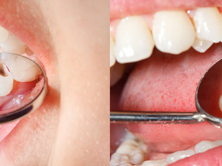 Dolci natalizi e salute dei denti: come proteggere il sorriso durante le feste