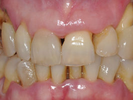 1 caso radicchi prima_ok.jpg