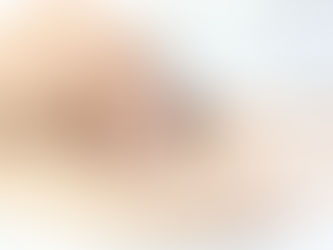 I METODI CONTRACCETTIVI ALTERNATIVI ALLA PILLOLA – L’ANELLO