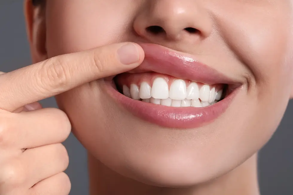estetica dentale
