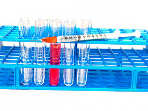 Test HIV su minori senza consenso genitori