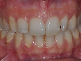 10 caso chiara prima_ok.jpg