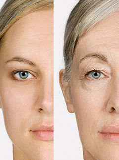 Các nguyên nhân gây lão hóa da hàng đầu 