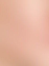 Dị ứng mỹ phẩm - Nguyên nhân, triệu chứng và cách phòng tránh