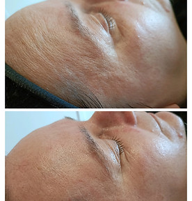 resultaat oxygeneo zuurstofbehandeling.jpg