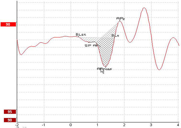 Figure-8-marked-points-area-ratio.jpg