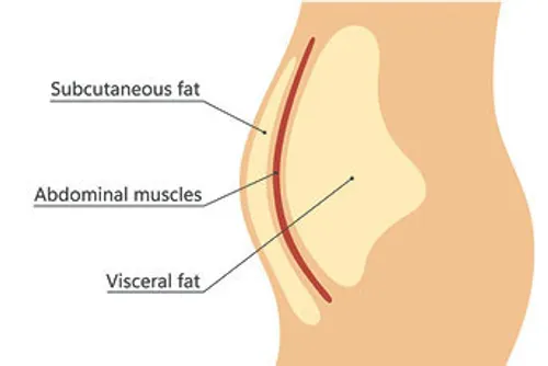 Visceral fat vs subcutaneous fat