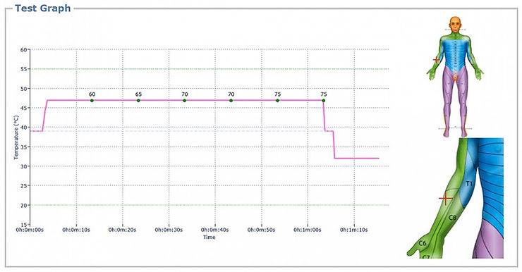 Phasic TS protocol - graph