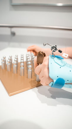 Schienenversorgung bei Strecksehnenverletzung