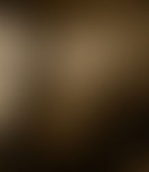 superdiagnósticos de TDAH