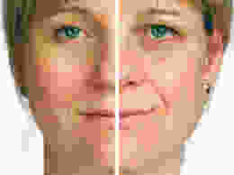 skin sleep study