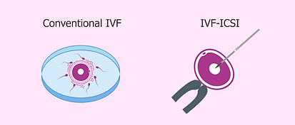 types-of-in-vitro-fertilization-available-today.png