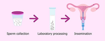IntraUterineInsemination.jpg